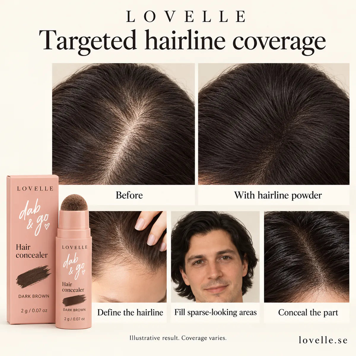 Dab &amp; Go in Dark Brown next to before and after images of hairline, thinning patches and parting